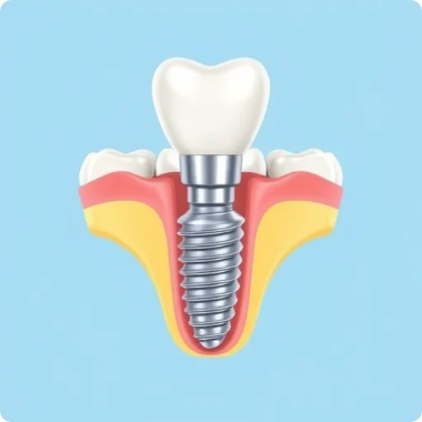 ملاحظات تکمیلی ایمپلنت